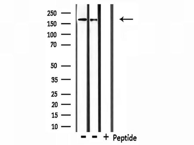 Collagen IV Antibody in Western Blot (WB)