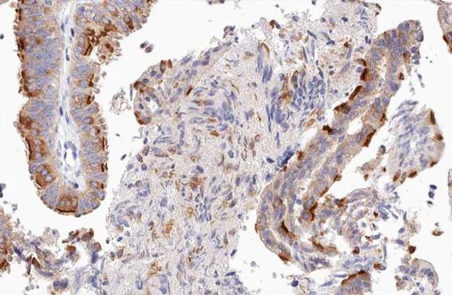 UBXD5 Antibody in Immunohistochemistry (Paraffin) (IHC (P))