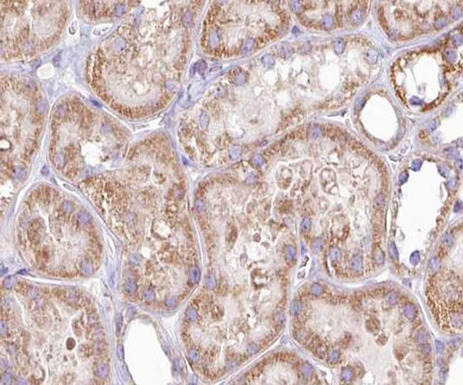 DGKH Antibody in Immunohistochemistry (Paraffin) (IHC (P))