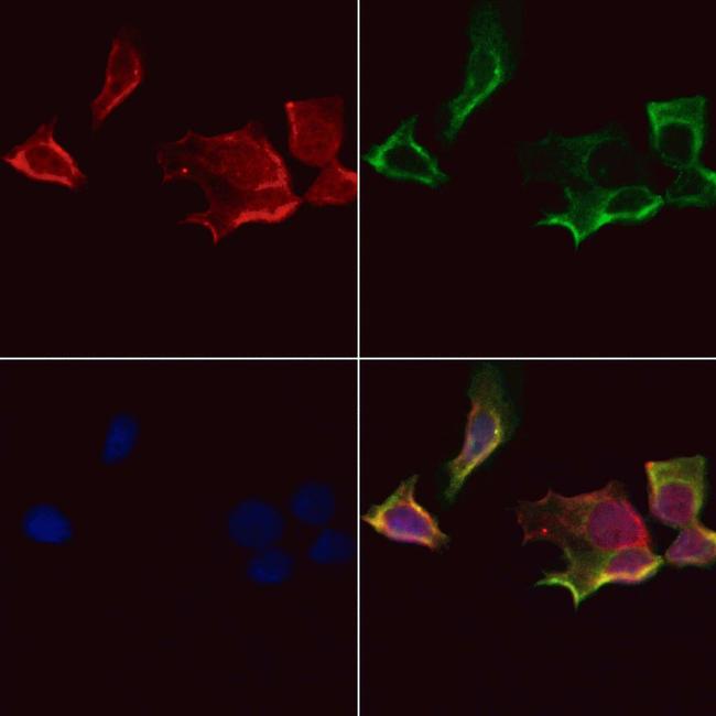 AKT Pan Antibody in Immunocytochemistry (ICC/IF)