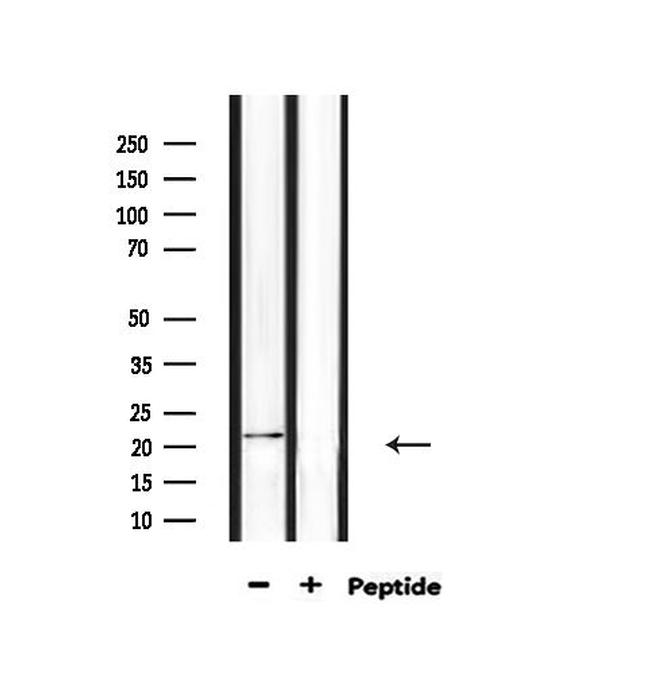 H1FOO Antibody in Western Blot (WB)