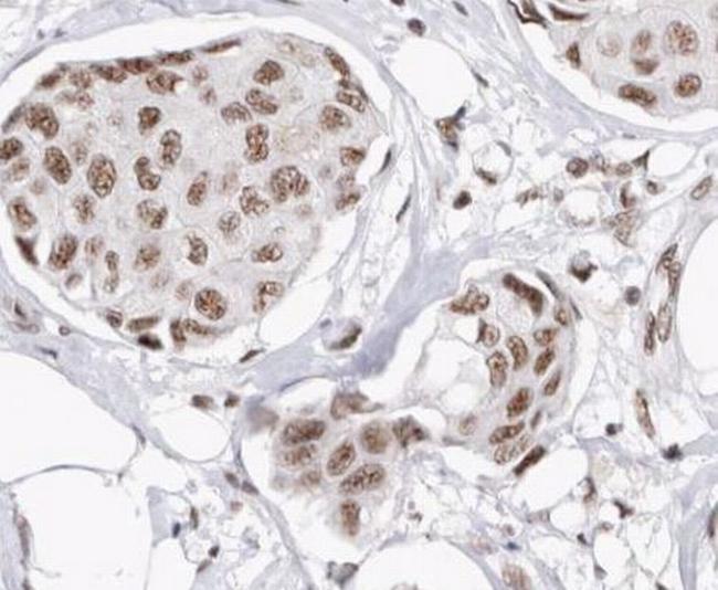 Phospho-Cyclin D1 (Thr286) Antibody in Immunohistochemistry (Paraffin) (IHC (P))