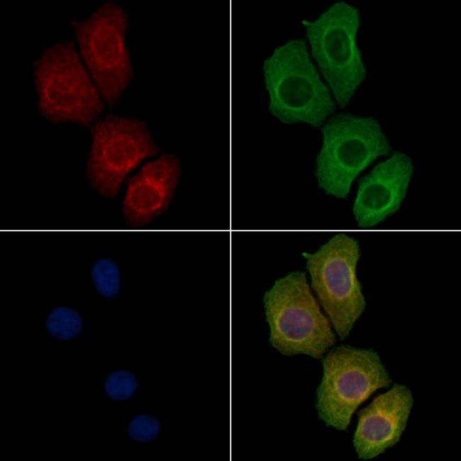 Phospho-DDR1 (Tyr513) Antibody in Immunocytochemistry (ICC/IF)