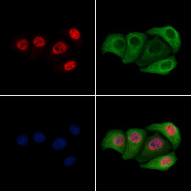 Phospho-RUNX1 (Ser249) Antibody in Immunocytochemistry (ICC/IF)