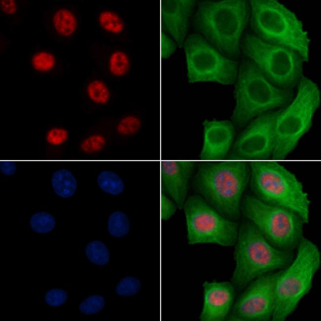 Phospho-BCL9L (Ser915) Antibody in Immunocytochemistry (ICC/IF)