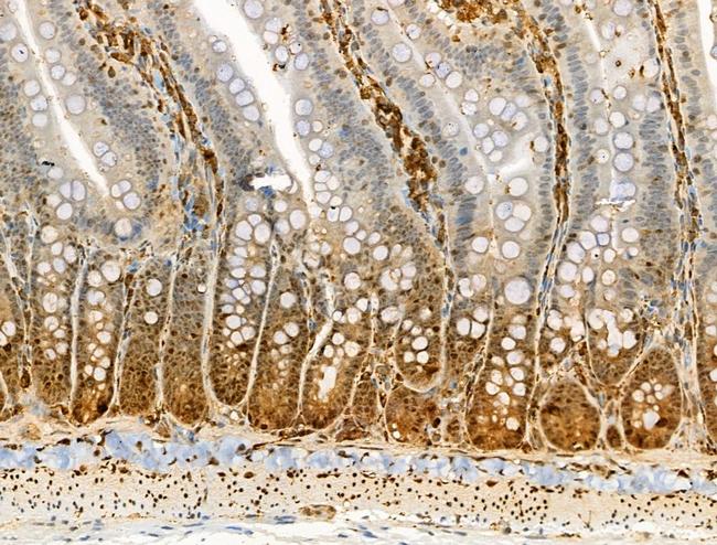 Phospho-Beclin 1 (Ser15) Antibody in Immunohistochemistry (Paraffin) (IHC (P))