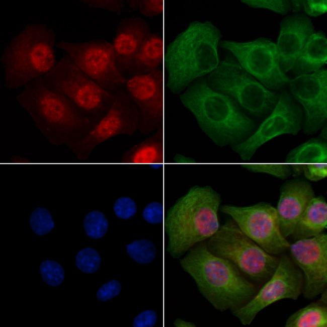 Phospho-CTDSPL2 (Ser104) Antibody in Immunocytochemistry (ICC/IF)