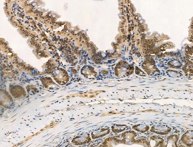 Phospho-DAB1 (Tyr220) Antibody in Immunohistochemistry (Paraffin) (IHC (P))