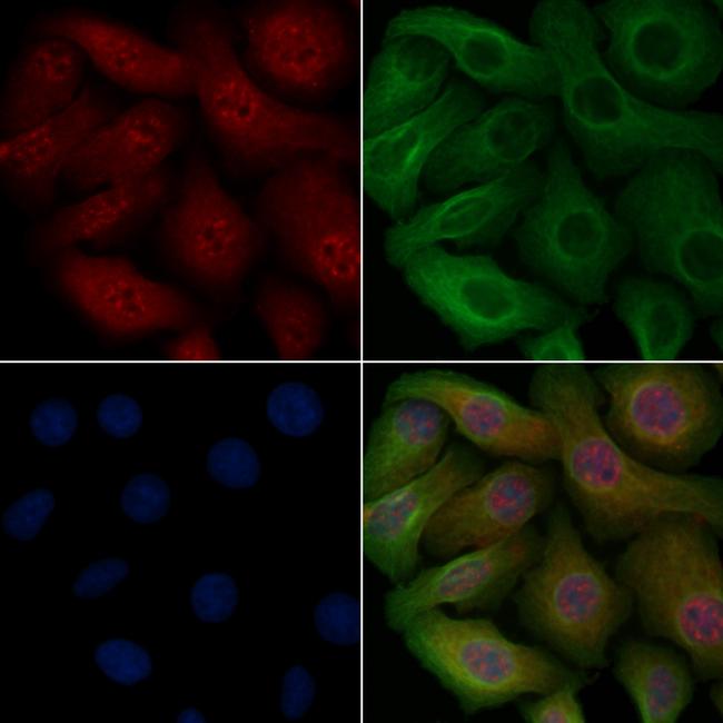 Phospho-EEF2K (Ser366) Antibody in Immunocytochemistry (ICC/IF)