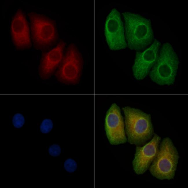 Phospho-ErbB2 (HER-2) (Tyr1196) Antibody in Immunocytochemistry (ICC/IF)