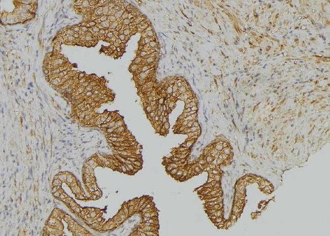 Phospho-Cytokeratin 17 (Ser44) Antibody in Immunohistochemistry (Paraffin) (IHC (P))