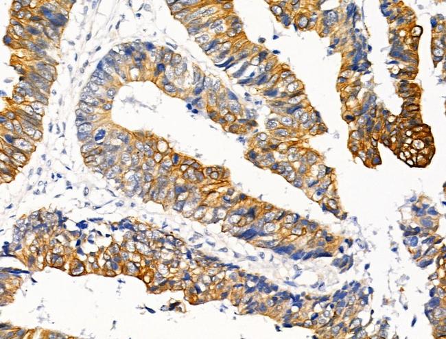 Phospho-Cytokeratin 20 (Ser13) Antibody in Immunohistochemistry (Paraffin) (IHC (P))