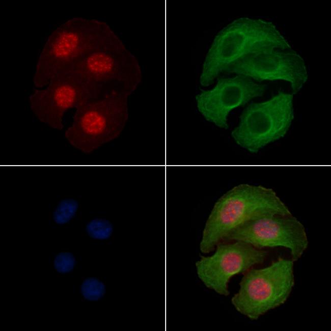 Phospho-MEK1 (Thr286) Antibody in Immunocytochemistry (ICC/IF)