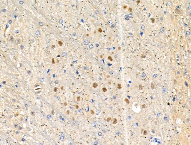 Phospho-NPM1 (Thr95) Antibody in Immunohistochemistry (Paraffin) (IHC (P))