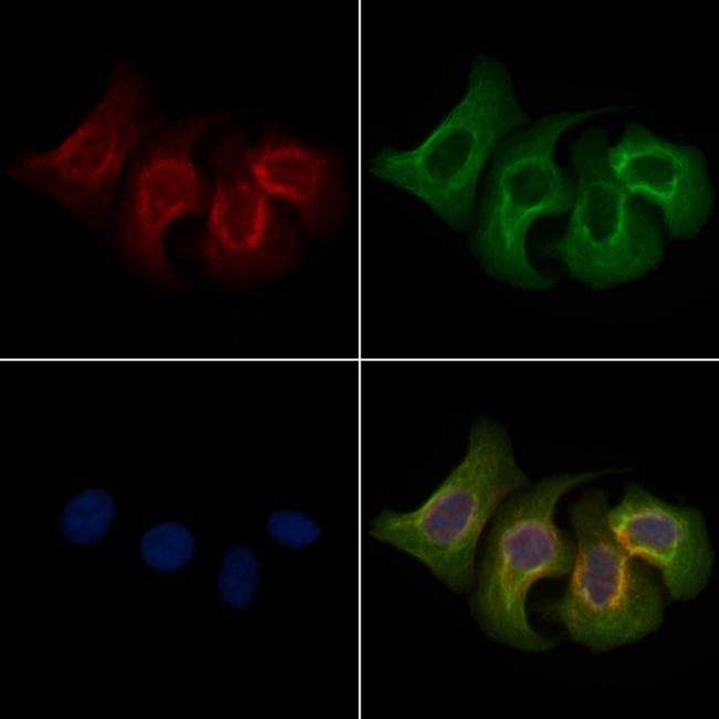 Phospho-PAK1/PAK2 (Ser199, Ser204, Ser192, Ser197) Antibody in Immunocytochemistry (ICC/IF)