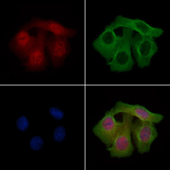 Phospho-PAK2 (Ser20) Antibody in Immunocytochemistry (ICC/IF)