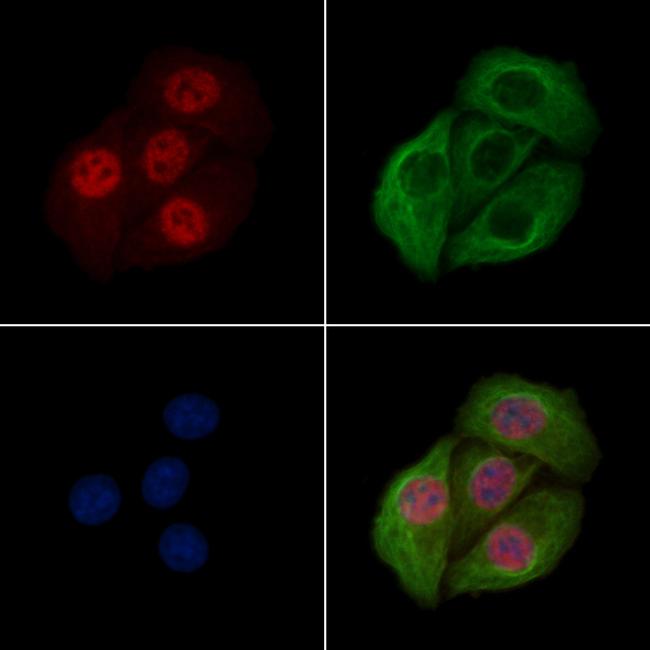 Phospho-PLK1 (Thr210) Antibody in Immunocytochemistry (ICC/IF)