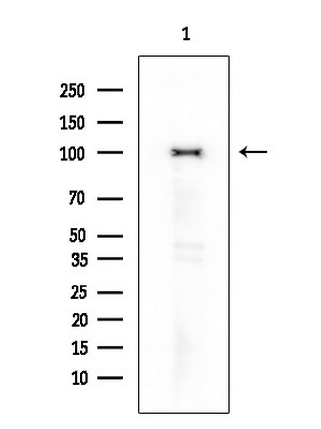 Phospho-PSD93 (Tyr340) Antibody in Western Blot (WB)