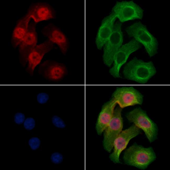 Phospho-Rb (Ser608) Antibody in Immunocytochemistry (ICC/IF)