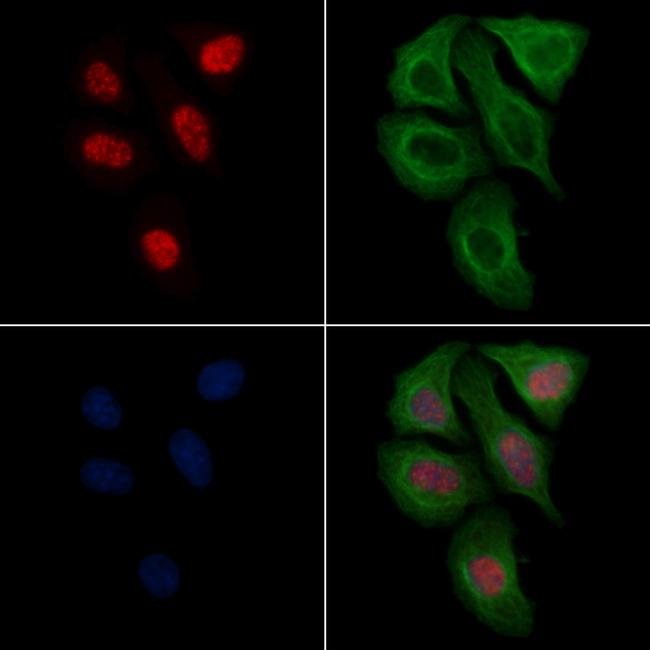 Phospho-SF3B1 (Thr313) Antibody in Immunocytochemistry (ICC/IF)