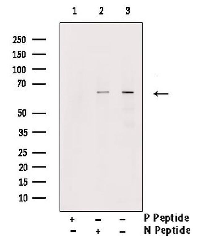 Phospho-SMAD1 (Ser206) Antibody in Western Blot (WB)