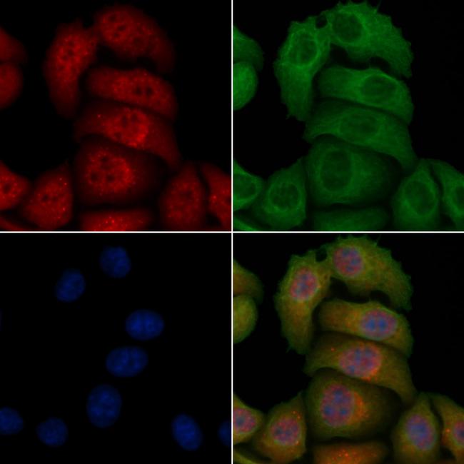 Phospho-SQSTM1 (Thr269, Ser272) Antibody in Immunocytochemistry (ICC/IF)