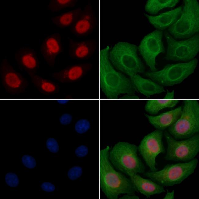 Phospho-SRC3 (Thr24) Antibody in Immunocytochemistry (ICC/IF)