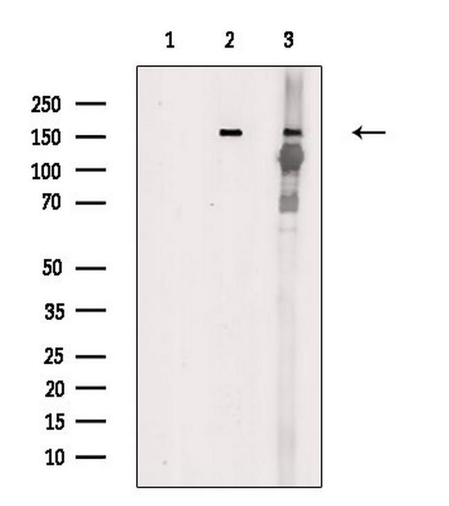 Phospho-TEK (Tyr992) Antibody in Western Blot (WB)