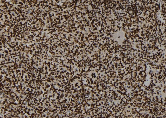 Phospho-TOP2A (Ser1469) Antibody in Immunohistochemistry (Paraffin) (IHC (P))