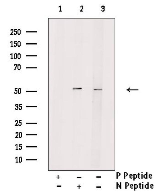 Phospho-TRAF2 (Ser11) Antibody in Western Blot (WB)