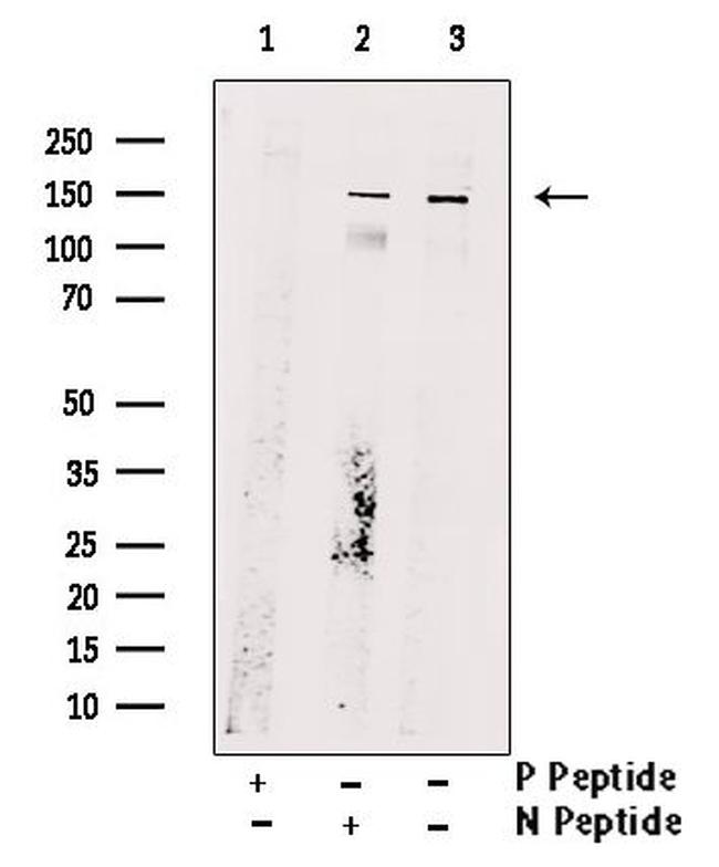 Phospho-ULK1 (Ser467) Antibody in Western Blot (WB)