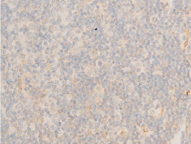 Phospho-IkappaB epsilon (Ser161) Antibody in Immunohistochemistry (Paraffin) (IHC (P))