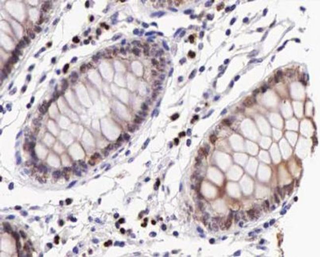 Phospho-IKK beta (Tyr199) Antibody in Immunohistochemistry (Paraffin) (IHC (P))