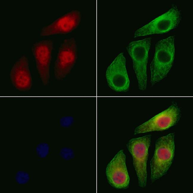 Phospho-IKK alpha/beta (Ser176, Ser177) Antibody in Immunocytochemistry (ICC/IF)