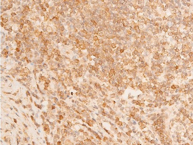 Phospho-p73 (Tyr99) Antibody in Immunohistochemistry (Paraffin) (IHC (P))