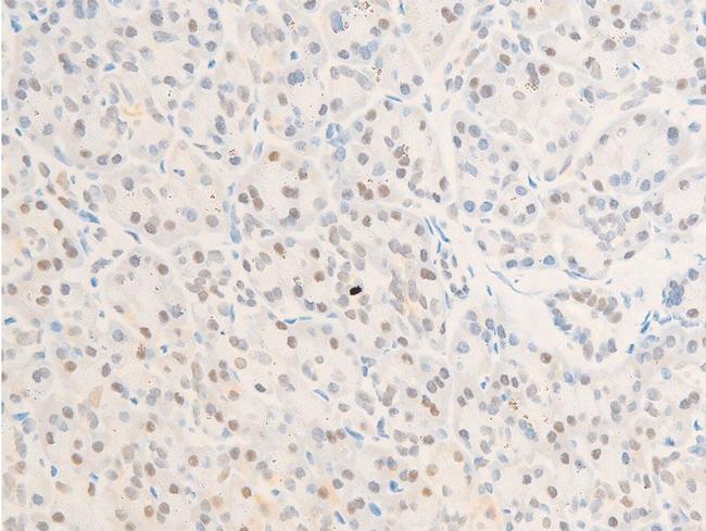 Phospho-Survivin (Thr117) Antibody in Immunohistochemistry (Paraffin) (IHC (P))