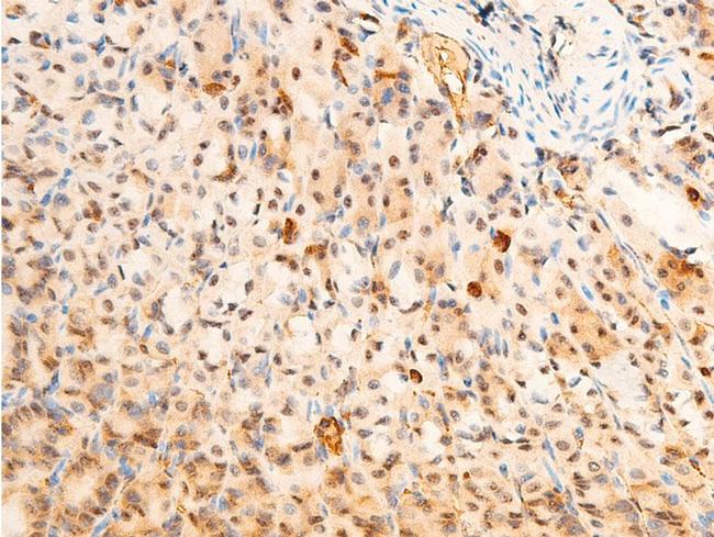 Phospho-PDPK1 (Ser241) Antibody in Immunohistochemistry (Paraffin) (IHC (P))