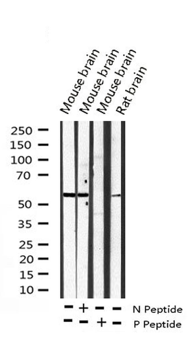 Phospho-DAB1 (Tyr232) Antibody in Western Blot (WB)