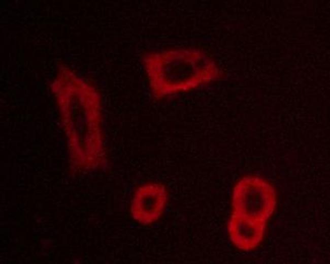 Phospho-EGFR (Tyr1016) Antibody in Immunocytochemistry (ICC/IF)