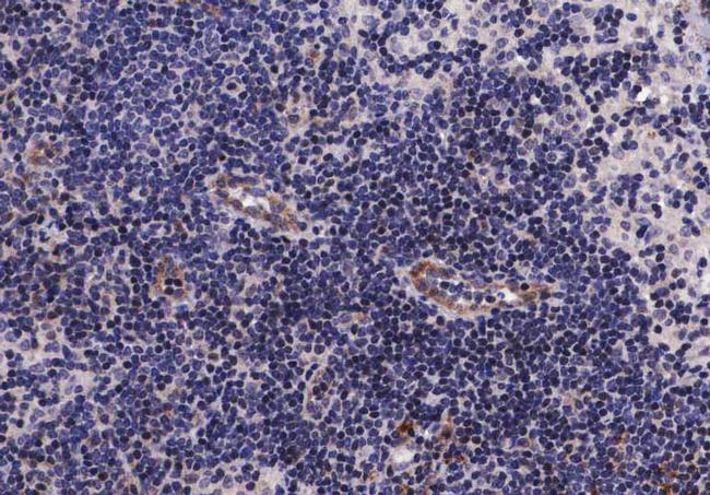 Phospho-EGFR (Ser1070) Antibody in Immunohistochemistry (Paraffin) (IHC (P))