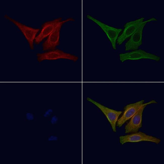 Phospho-EGFR (Tyr1092) Antibody in Immunocytochemistry (ICC/IF)