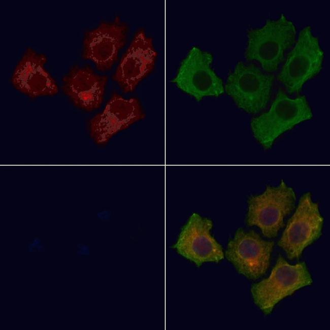 Phospho-EGFR (Tyr1197) Antibody in Immunocytochemistry (ICC/IF)