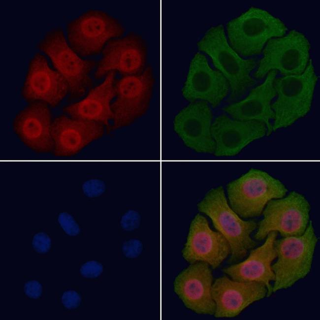 Phospho-EGFR (Ser1026) Antibody in Immunocytochemistry (ICC/IF)