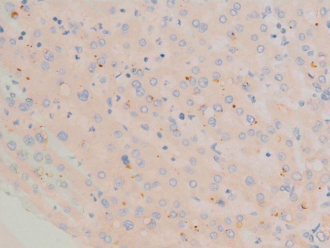 Phospho-c-Fos (Ser362) Antibody in Immunohistochemistry (Paraffin) (IHC (P))