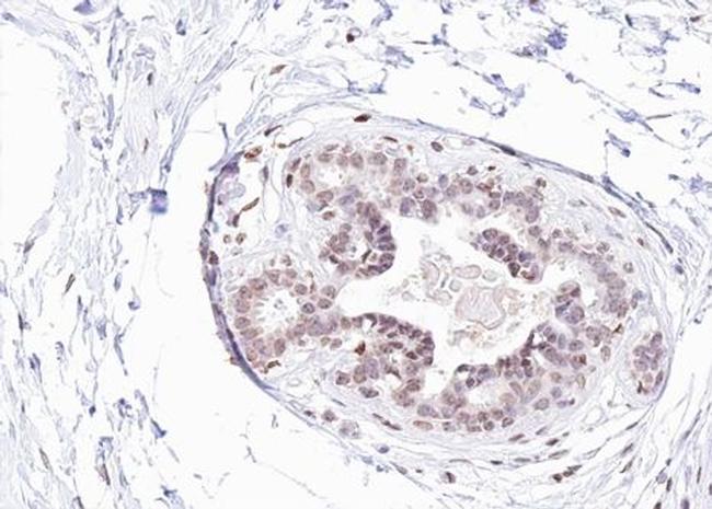 Phospho-Estrogen Receptor alpha (Tyr537) Antibody in Immunohistochemistry (Paraffin) (IHC (P))