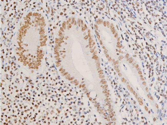 Phospho-Glucocorticoid Receptor (Ser226) Antibody in Immunohistochemistry (Paraffin) (IHC (P))