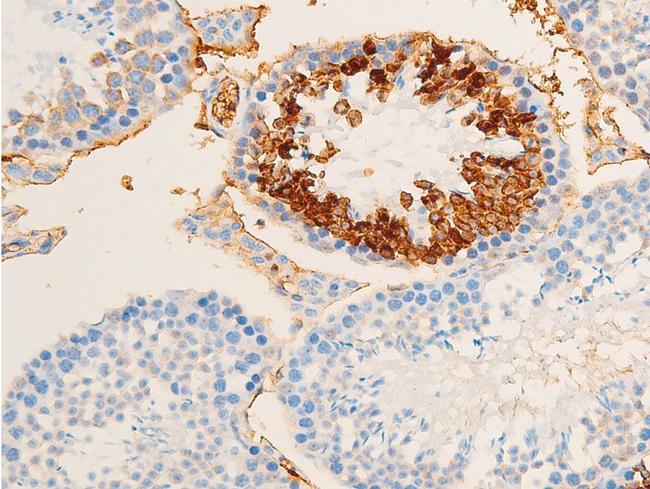 Phospho-TK1 (Ser13) Antibody in Immunohistochemistry (Paraffin) (IHC (P))