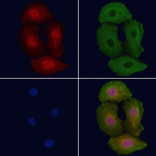 Phospho-ErbB2 (HER-2) (Tyr1112) Antibody in Immunocytochemistry (ICC/IF)