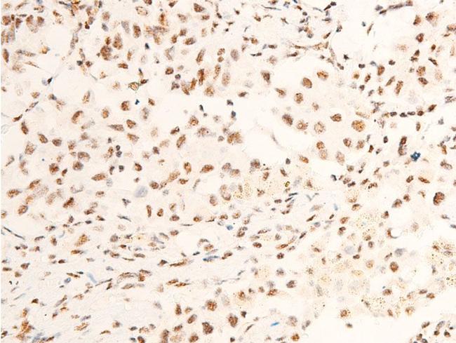 Phospho-TrkA (Tyr680, Tyr681) Antibody in Immunohistochemistry (Paraffin) (IHC (P))