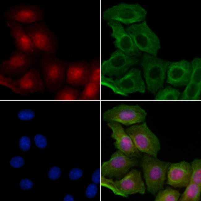 Phospho-p53 (Ser20) Antibody in Immunocytochemistry (ICC/IF)